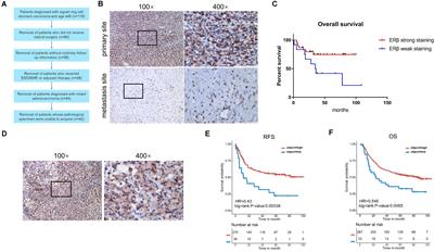 Estrogen Receptor Beta Prevents Signet Ring Cell Gastric Carcinoma Progression in Young Patients by Inhibiting Pseudopodia Formation via the mTOR–Arpc1b/EVL Signaling Pathway